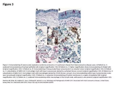 Figure 3 Figure 3. Immunostaining of severe acute respiratory syndrome coronavirus 2 in