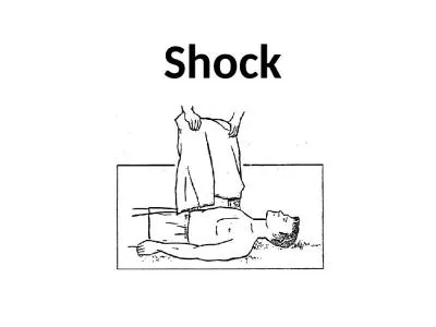 Shock  Outlines  Definitions