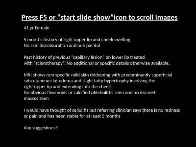 41  yr  Female 5 months history of right upper lip and cheek swelling