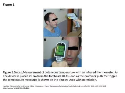 Figure 1 Figure 1.&nbsp;Measurement of cutaneous temperature with an infrared thermometer. A) T