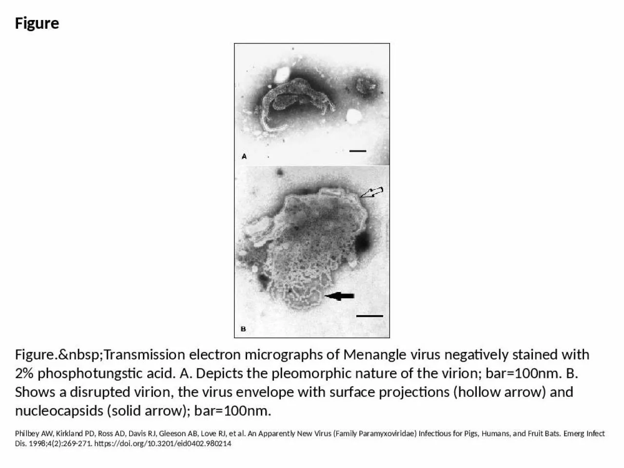 PPT-Figure Figure.&nbsp;Transmission electron micrographs of Menangle virus negatively