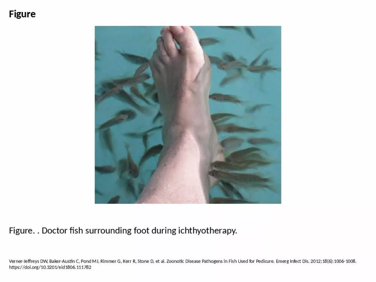 PPT-Figure Figure. . Doctor fish surrounding foot during ichthyotherapy.