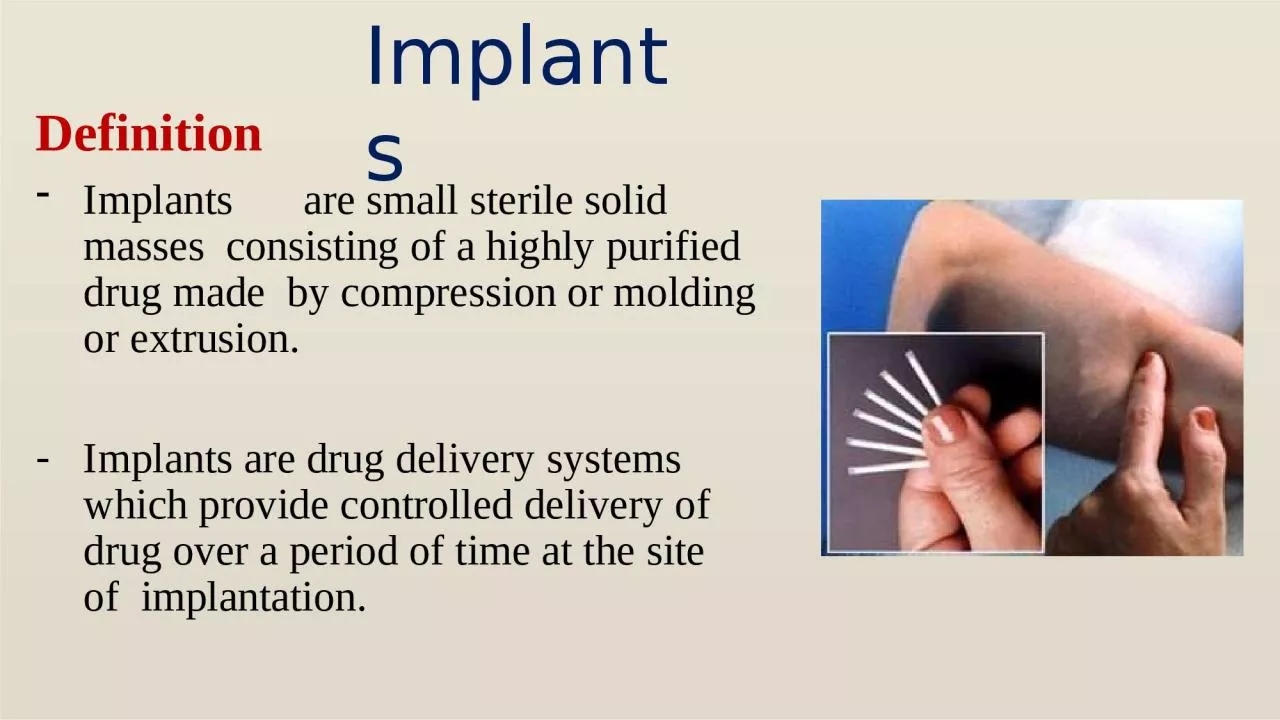 PPT-Definition Implants are small sterile solid masses consisting of a highly purified drug