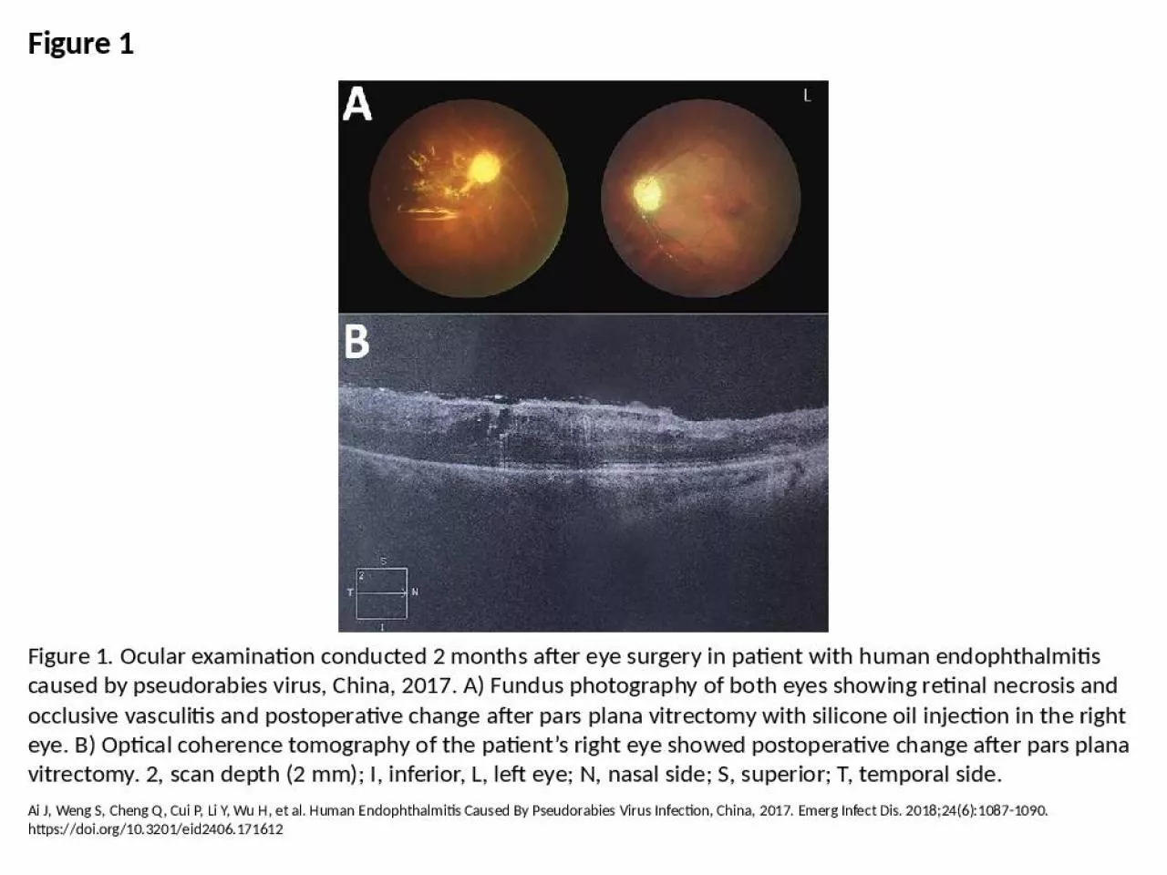 PPT-Figure Figure Ocular China Fundus Optical