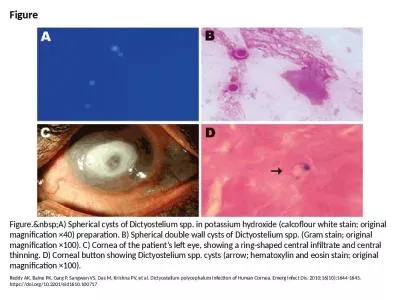 Spherical Dictyostelium Spherical Dictyostelium Cornea Corneal