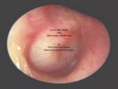 Acute otitis Media And Otitis Media with Effusion   By Prof. Ehab Taha Yaseen Head of department of Surgery