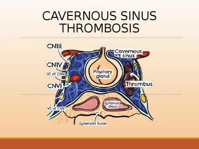 CAVERNOUS SINUS THROMBOSIS