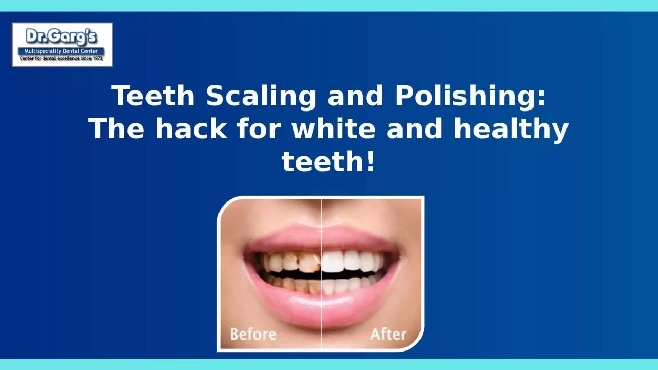 PPT-Teeth Scaling and Polishing: The hack for white and healthy teeth!