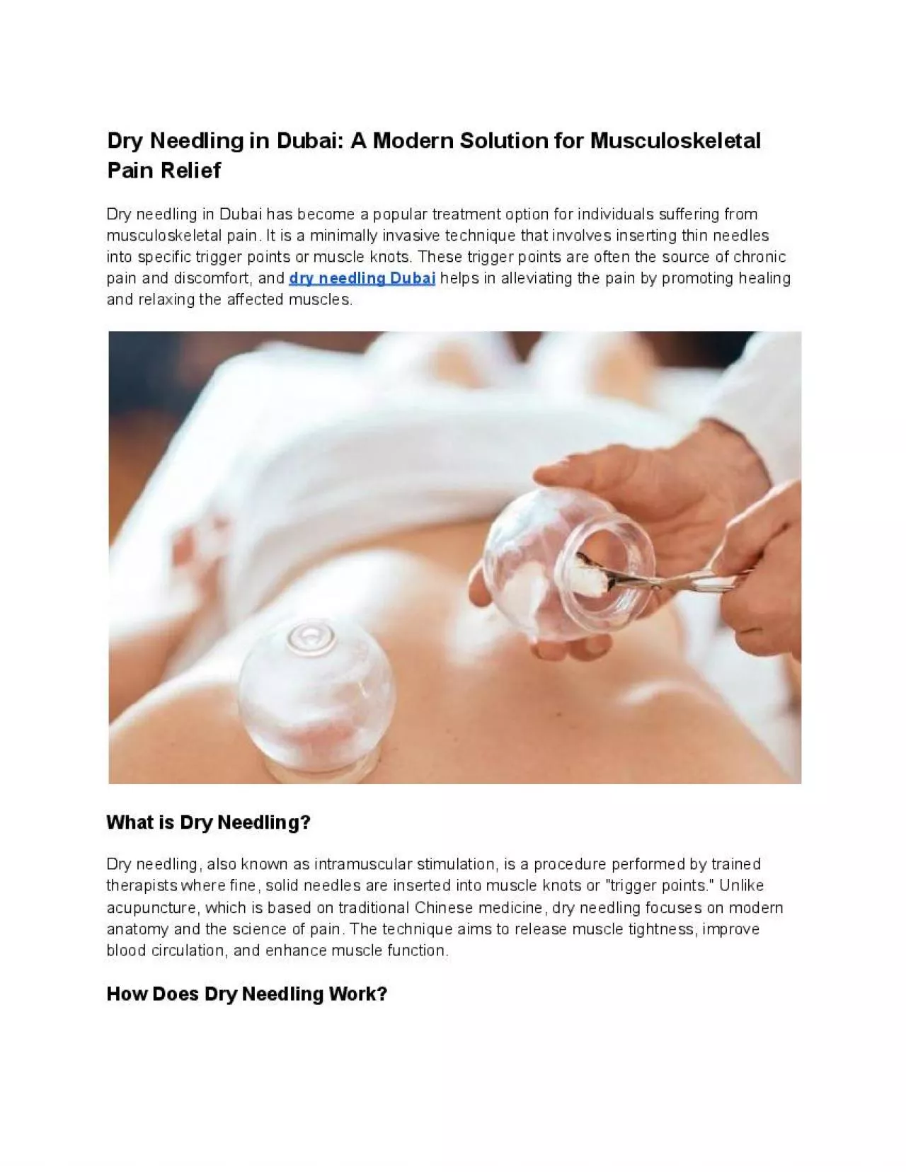 PDF-Dry Needling in Dubai: A Modern Solution for Musculoskeletal Pain Relief