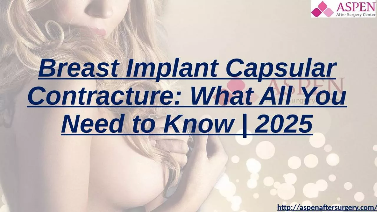 PPT-Breast Implant Capsular Contracture - What All You Need to Know in 2025