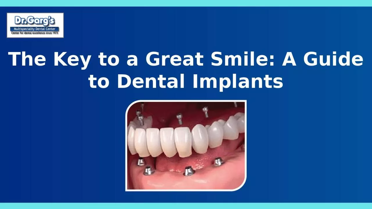 PPT-The Key to a Great Smile: A Guide to Dental Implants