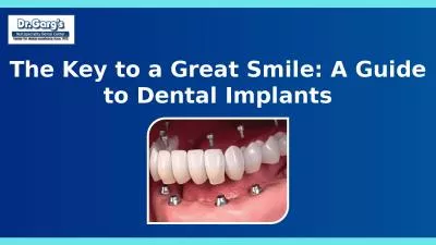 The Key to a Great Smile: A Guide to Dental Implants