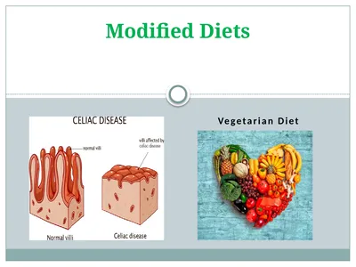 Modified Diets Vegetarian Diet Test Your Knowledge
