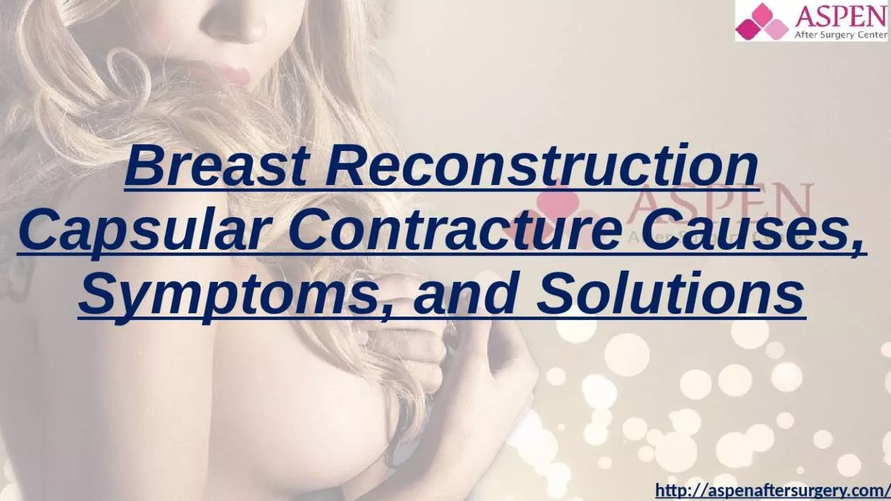 PPT-Breast Reconstruction Capsular Contracture Causes, Symptoms, and Solutions