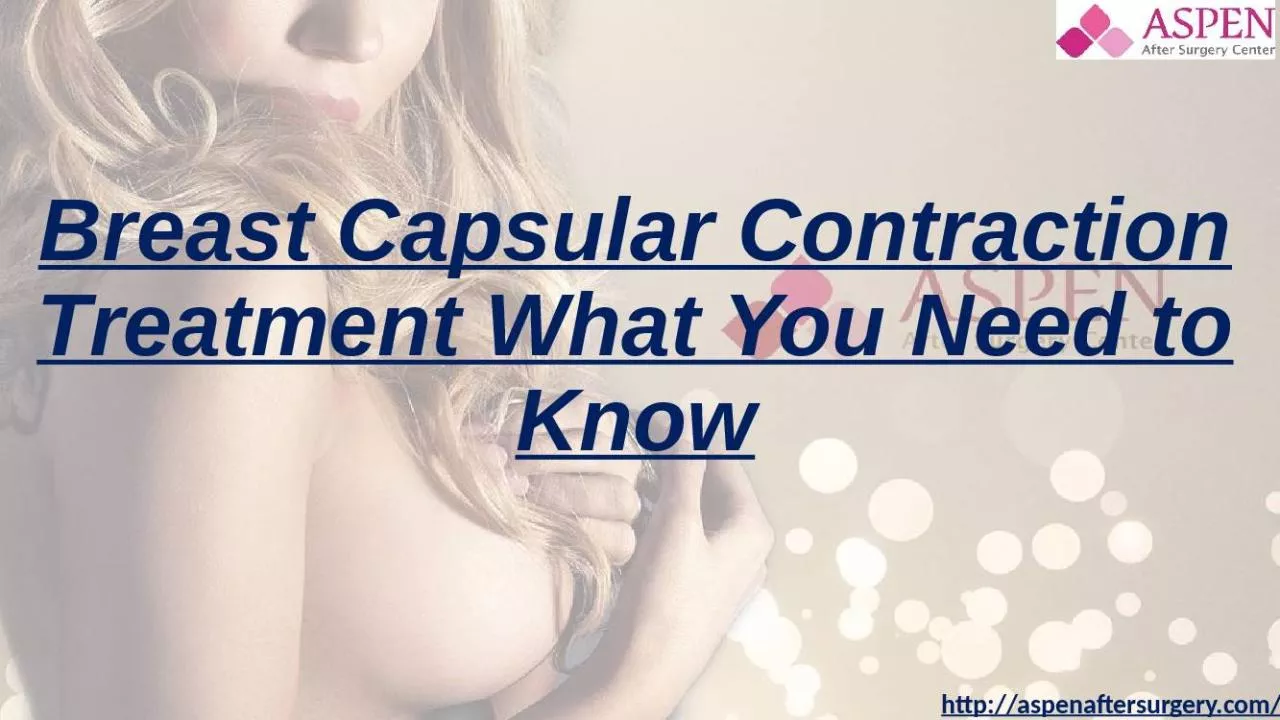 PPT-Breast Capsular Contraction Treatment What You Need to Know