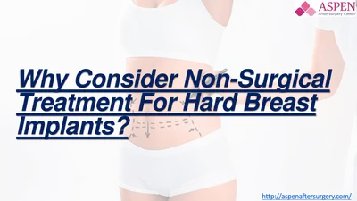 Why Consider Non-Surgical Treatment For Hard Breast Implants
