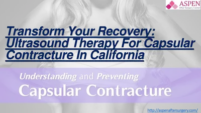 Transform Your Recovery Ultrasound Therapy For Capsular Contracture In California