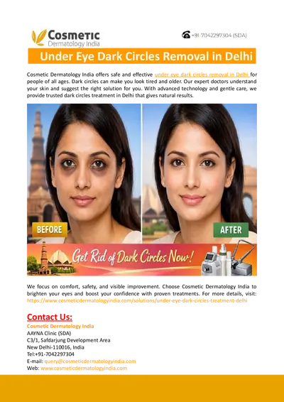 Under Eye Dark Circles Removal in Delhi