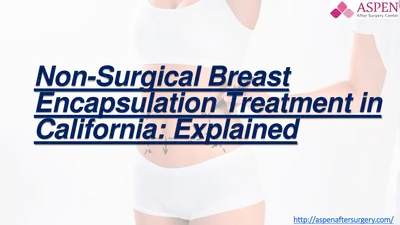 Non-Surgical Breast Encapsulation Treatment in California Explained