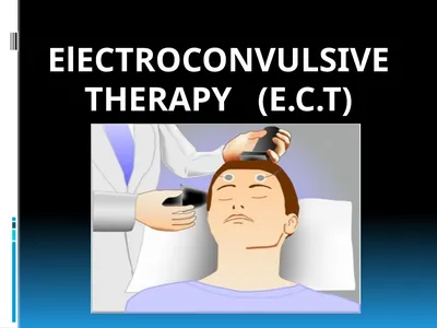 ElECTROCONVULSIVE THERAPY (E.C.T) INTRODUCTION:-