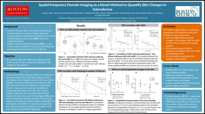 Background Spatial Frequency Domain Imaging as a