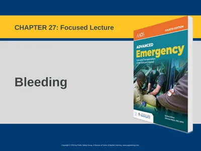 Bleeding CHAPTER 27: Focused Lecture National EMS