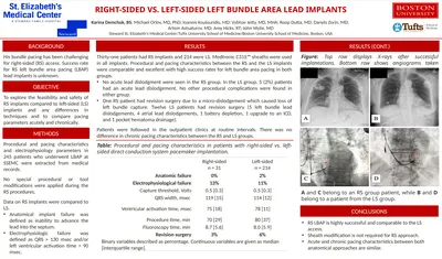 RIGHT-SIDED VS. LEFT-SIDED LEFT BUNDLE AREA LEAD