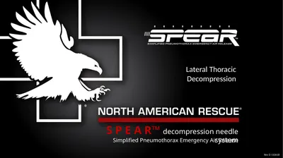 S P E A R™ decompression needle system Simplified