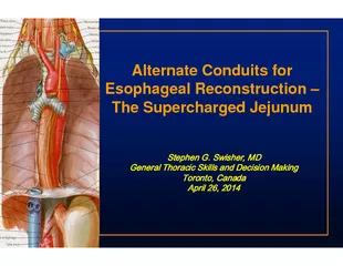 Esophageal Reconstruction 