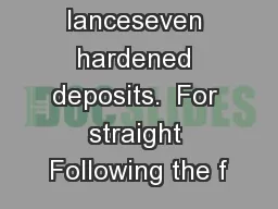 30flexible lanceseven hardened deposits.  For straight Following the f