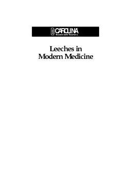 Leeches in Modern Medicine