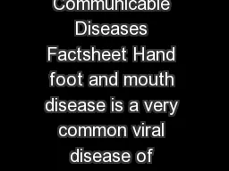 Hand Foot and Mouth disease page of Communicable Diseases Factsheet Hand foot and mouth disease is a very common viral disease of childhood which is easily passed from person to person