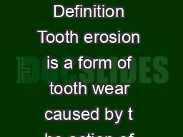 TOOTH EROSION Definition Tooth erosion is a form of tooth wear caused by t he action of acid on tooth substance