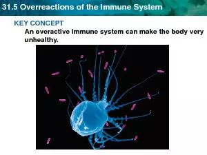 31.5 Overreactions of the Immune System