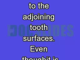 close approximation to the adjoining tooth surfaces. Even thoughit is