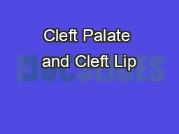 Cleft Palate and Cleft Lip