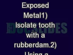 Sequence 1 - Exposed Metal1) Isolate tooth with a rubberdam.2) Using a