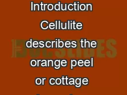 Cellulite a review of its physiology and treatment Mathew M Avram Introduction Cellulite