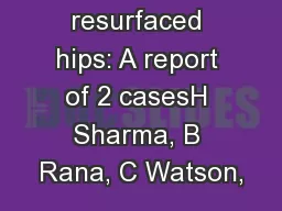 metal resurfaced hips: A report of 2 casesH Sharma, B Rana, C Watson,