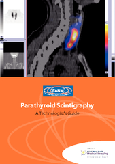 Parathyroid Scintigraphy