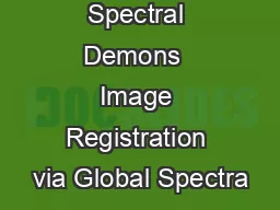 Spectral Demons  Image Registration via Global Spectra