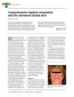 Comprehensive implant restoration and the shortened dental archRoger A