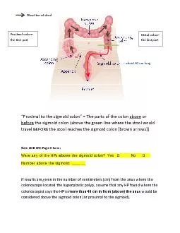 “Proximal to the sigmoid colon” = The partof the colon above