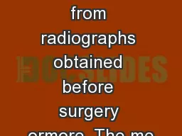 chronic either from radiographs obtained before surgery ormore. The me