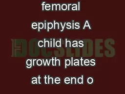 Slipped upper femoral epiphysis A child has growth plates at the end o