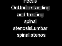 Focus OnUnderstanding and treating spinal stenosisLumbar spinal stenos