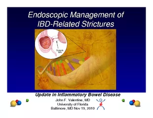 Endoscopic Management of Endoscopic Management of IBDIBD--Related Stri