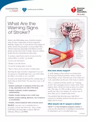 Stroke is the �fth leading cause of death in America 
...