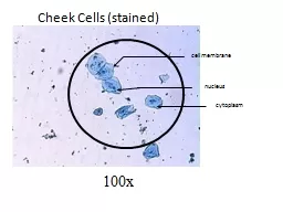 Cheek Cells (stained)