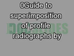0Guide to superimposition of profile radiographs by